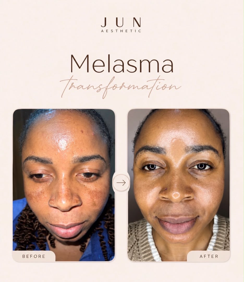 JUN Aesthetic client results